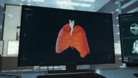 Modern medical analysis software is used during the therapy of a cancer patient alt