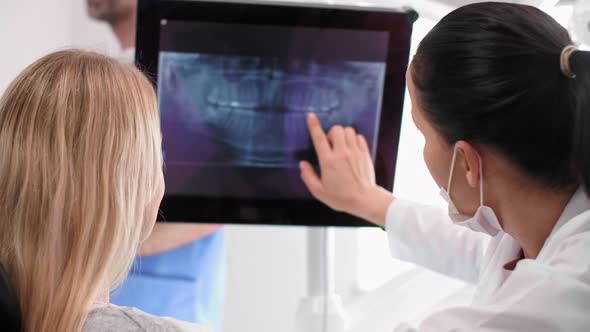 Female Dentist Pointing at Patient's X-Ray