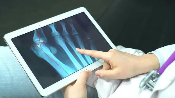 Doctor Explores the X-ray Snapshot on the Tablet. Patient Advice Before Operation