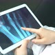 Doctor Explores the X-ray Snapshot on the Tablet. Patient Advice Before Operation - VideoHive Item for Sale