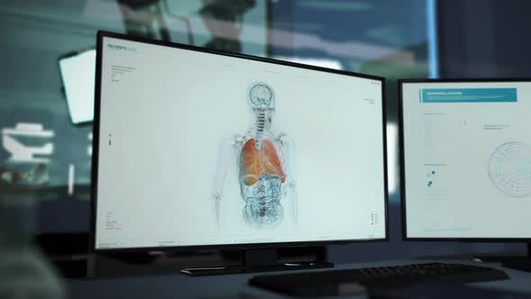 Biological Lung Analysis On Screen In Modern Medical Interface Animation alt