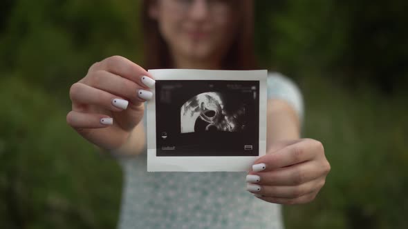 A Young Pregnant Woman Holds an Ultrasound Picture of a Baby in Her Hands