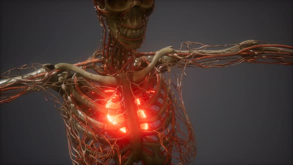 CG Animation Of A Sick Human Heart alt
