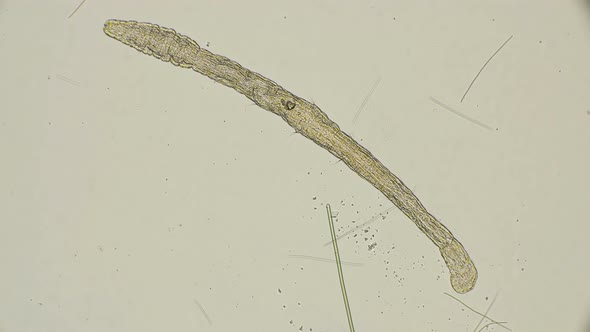 Worm of the Family Aeolosomatidae
