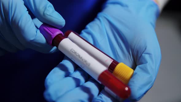 Hand Holding Beakers with Coronavirus Blood Test