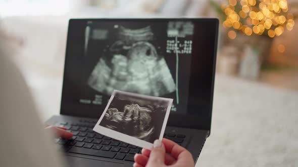 in Female Hands a Laptop with a Video and Photo of the Ultrasound of the Unborn Child