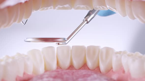 Dentist Inspects Teeth with Probe and Mirror