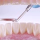 Dentist Inspects Teeth with Probe and Mirror - VideoHive Item for Sale