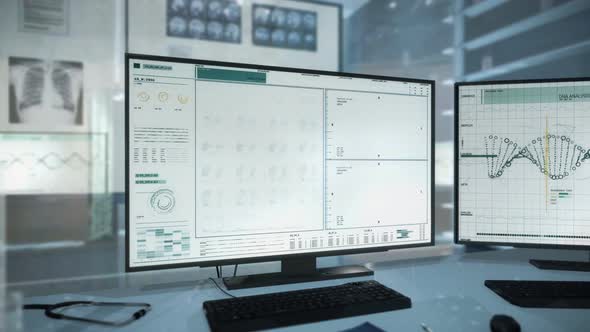 Lung CT Scan on the main monitor. The traces of Covid-19 Pneumonia were found. alt