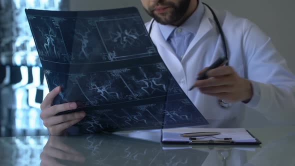 Neurosurgeon Looking at Cerebral Vessels X-Ray and Making Notes in Medical Form