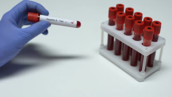 Positive Hepatitis B Test, Doctor Showing Blood Sample in Tube, Health Checkup
