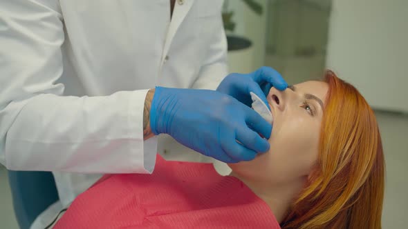 the Dentist Installs a Lip Retractor for the Patient