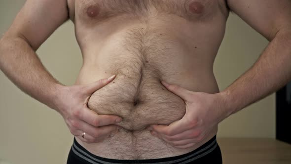 Plump Man Shows Folds Excess Fat His Belly