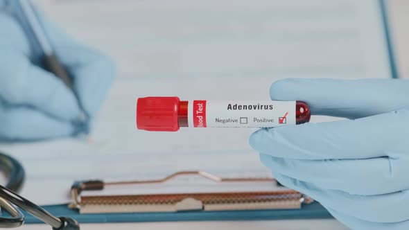 The Doctor Holds Hand Blood Sample Positive with Adenovirus