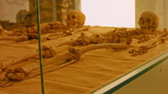 Human Skull in a Showcase