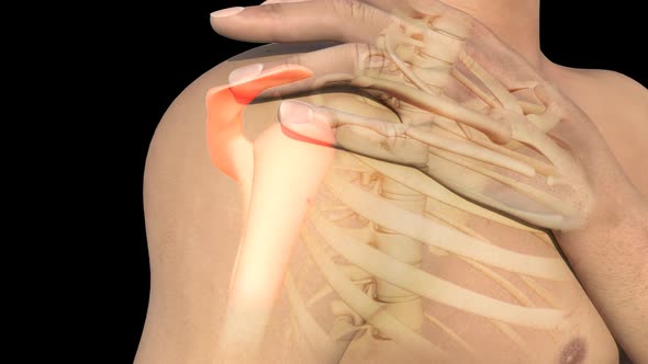 Man With Shoulder Pain alt