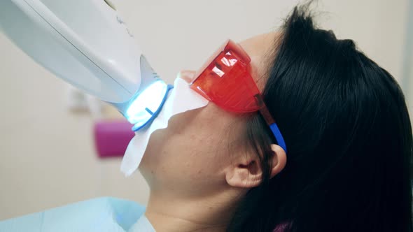 A Woman is Going Through Dental Bleaching