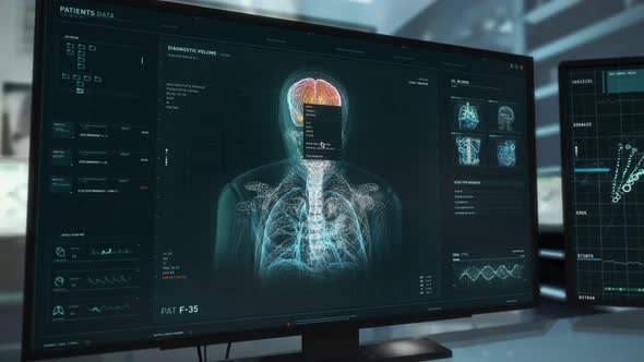 Human Brain Biology Laboratory Scan In Innovative Medical Software Interface alt