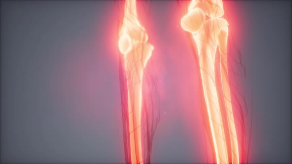 Transparent Human Body with Visible Bones alt