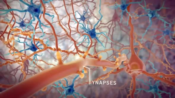 Neurons With Amyloid Plaques, Animation