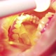Oral Cavity with Gums Getting Treated in a Close Up - VideoHive Item for Sale