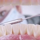 Dentist Inspects Patient's Teeth with Probe and Mirror - VideoHive Item for Sale
