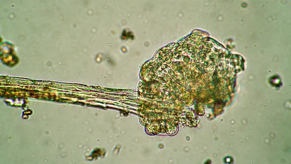 The Tardigrade Is Walking Over the Stick and Tries Hardly To Tear Away From It