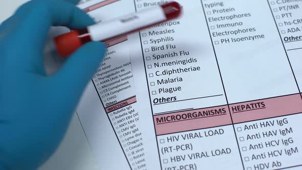 Malaria, Doctor Checking Disease in Lab Blank, Showing Blood Sample in Tube