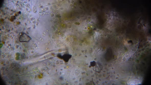 a variety of simple organisms in the aquatic environment, taken under a microscope