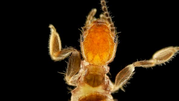 Embioptera insect under a microscope