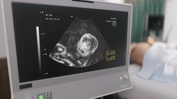 Conducting Medical Analysis With Scanner To Check Baby Health Before Childbirth