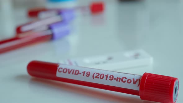 Selective Moving Focus on Tube with Blood Sample and Test for Coronavirus COVID-19