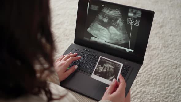 a Young Pregnant Woman Watches a Video of an Ultrasound of a Child on a Laptop and Holds an