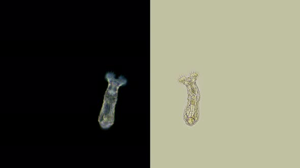 Rotifers Philodina Sp. Under a Microscope, Family Philodinidae, Class Bdelloidea