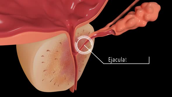 Section Bladder And Prostate Overview