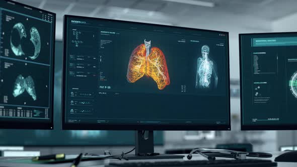Diagnosing the patient with deadly cancer after the x-ray examination of lungs alt