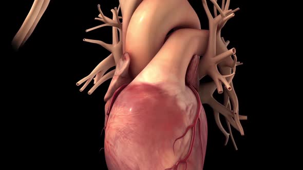 Coronary artery bypass surgery is done using a healthy blood vessel called a graft.