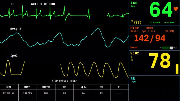 Electronic Health Monitor Machine Detects Decline In Vital Signs Of Patient alt