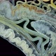 Worm Polychaeta Under a Microscope - VideoHive Item for Sale