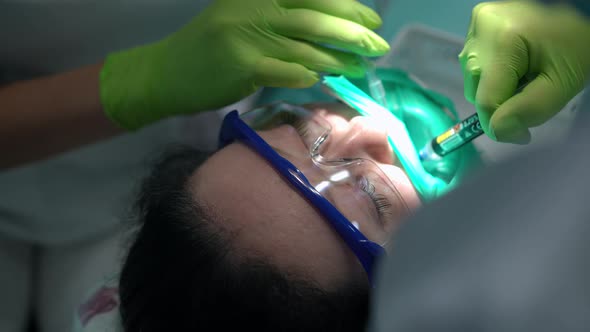 Closeup Unrecognizable Doctor Using Dental Irrigation Syringe in Slow Motion in Hospital