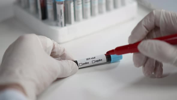 Covid 19 Infected Blood Sample in Sample Tube in Hand of Scientist