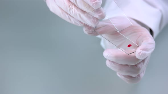 Close Up Scientist Holding Glass Slide with Blood Drop