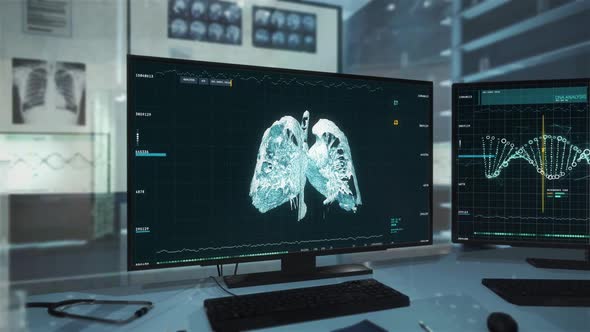 Lungs appearing on screen. Covid-19 pneumonia detected on the side of lungs. UI alt