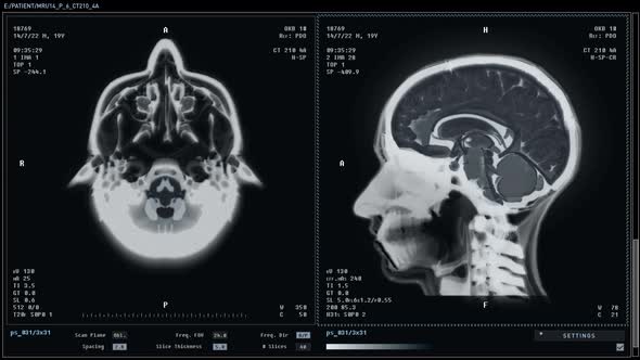 Modern X-Ray Machine Scanning Human Skull To Examine Brain Organ Damage alt