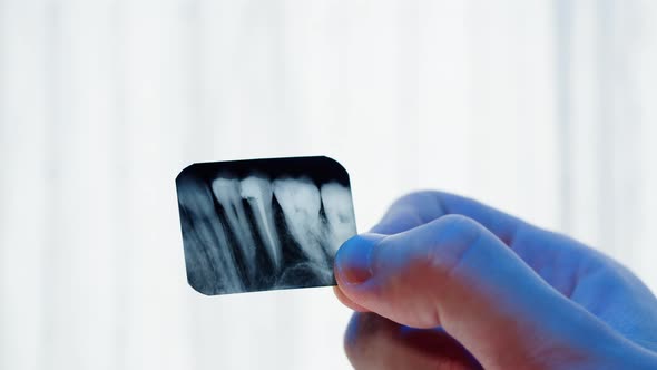 Teeth Xray Closeup