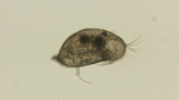 Crustacea Ostracoda Under the Microscope