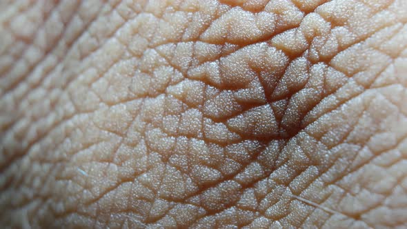 Human Skin Analysis