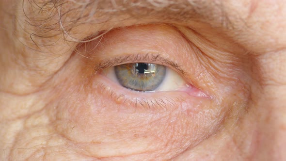 The Eye of a Very Old Man Closeup