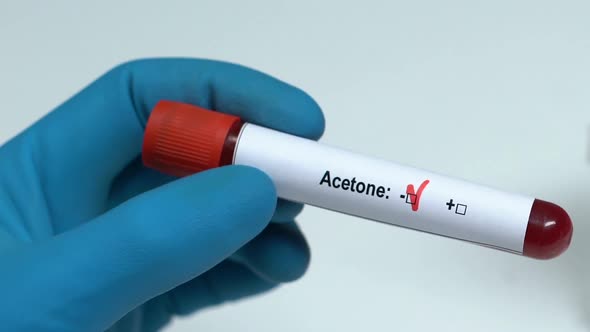 Acetone, Doctor Holding Blood Sample in Tube Close-Up, Health Examination