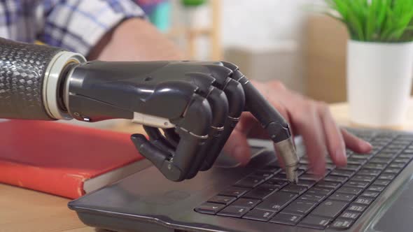 Young Man with a Prosthetic Arm Is Working at a Laptop Close Up